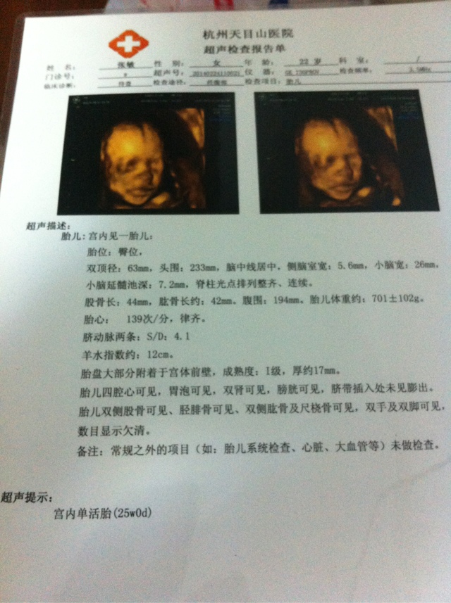 1、四维彩超看男胎儿图:如何用彩超图片辨别男女