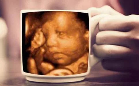 3、四维彩超看男胎儿图:七个月四维彩超图片，看下是男孩女孩？