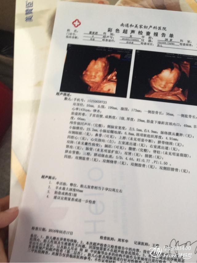 3、女胎儿四维彩超图片:七个月四维彩超图片，看下是男孩女孩？