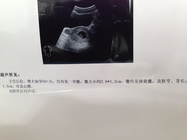 3、怀孕多久可以查出来男女:怀孕12周NT检测医生说血管细,暗示是女孩吗