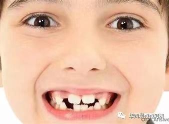 儿童10岁门牙有八字缝